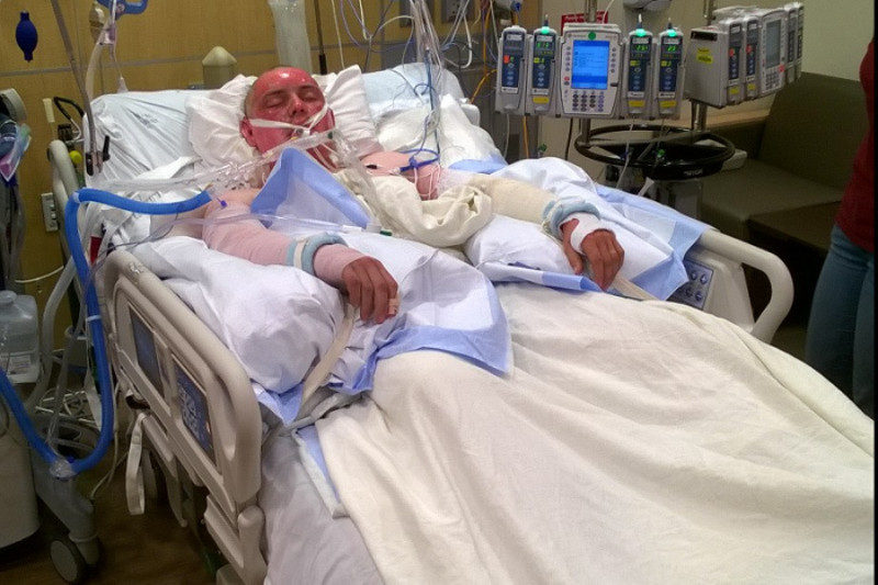 Two firefighters recovering after being seriously burned in fire East