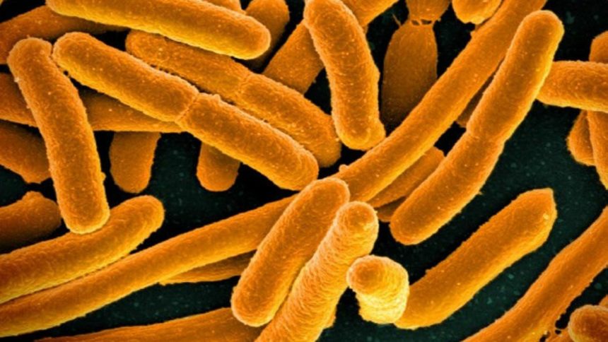 e coli cdc