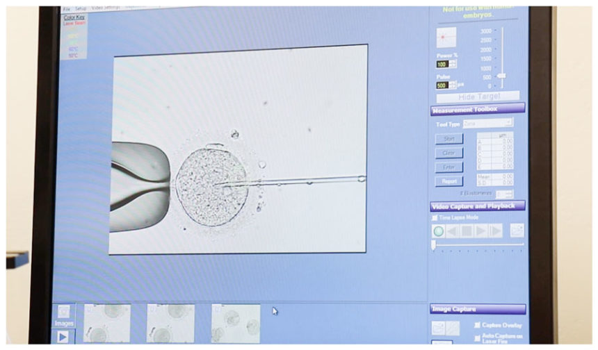 Fertility Clinic Got Woman Pregnant With Someone Else's Babies: Lawsuit