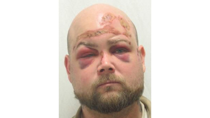 Anthony Rentelman, DUI injury to a child
