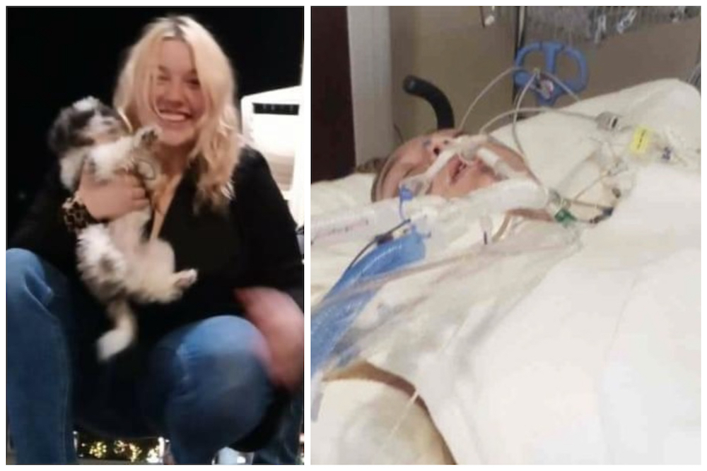 'Her palms are completely gone.' Woman trying to save dog from Yellowstone hot spring has burns on 90% of her body - Vimarsana News