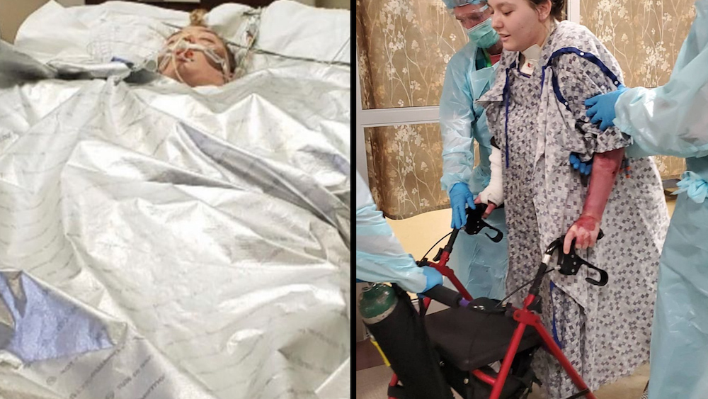 'It's a miracle.' Woman who fell into Yellowstone hot spring released from hospital after 4 months - Vimarsana News